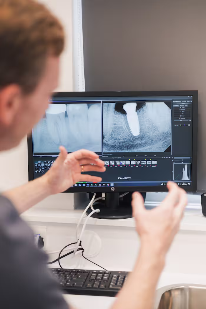 Dental implants before and after transformation